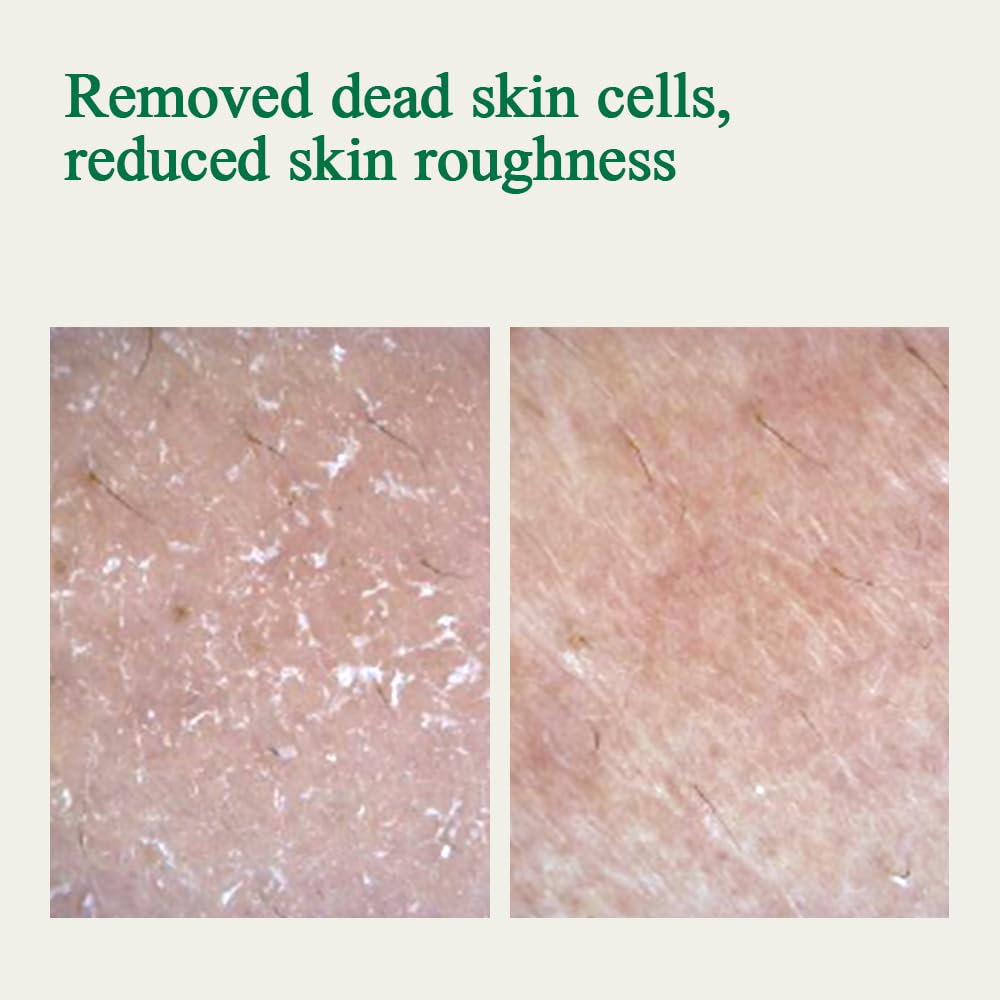 Pyunkang Yul PKY Ultimate Calming Solution Cream for Sensitive Skin with Patented Ingredients, Moisturizer Intensely Calms & Soothes Redness with Cica & Tea Tree, Korean Skincare (1.01 Fl. Oz, 30ml)