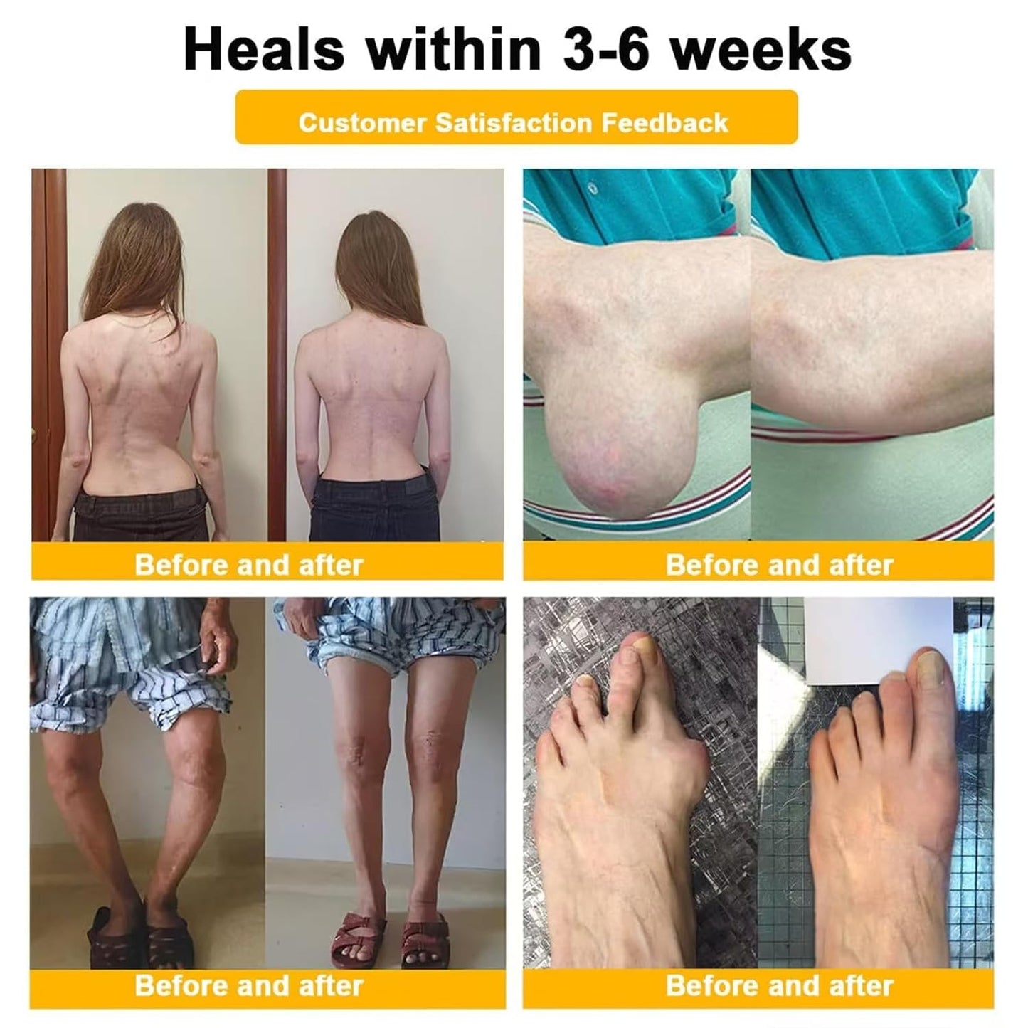 Botulinum Toxin & Bee Venom Pain-Relief Bone Healing Cream, 2025 New Bee Venom Cream for Arthritis, Bee Venom Joint Therapy Pain Relief Gel for Back, Knee, Hands, Neck, Feet, for All Skin Types(2PCS)