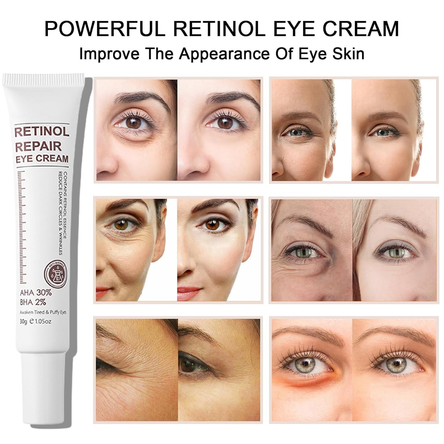 Retinol Eye Cream With Retinol Serum & AHA 30% & BHA 2% -Under Eye Cream For Dark Circles Puffy Eyes -Retinol Anti-Aging Eye Cream For Wrinkles Instant Eye Tightener For Women & Men