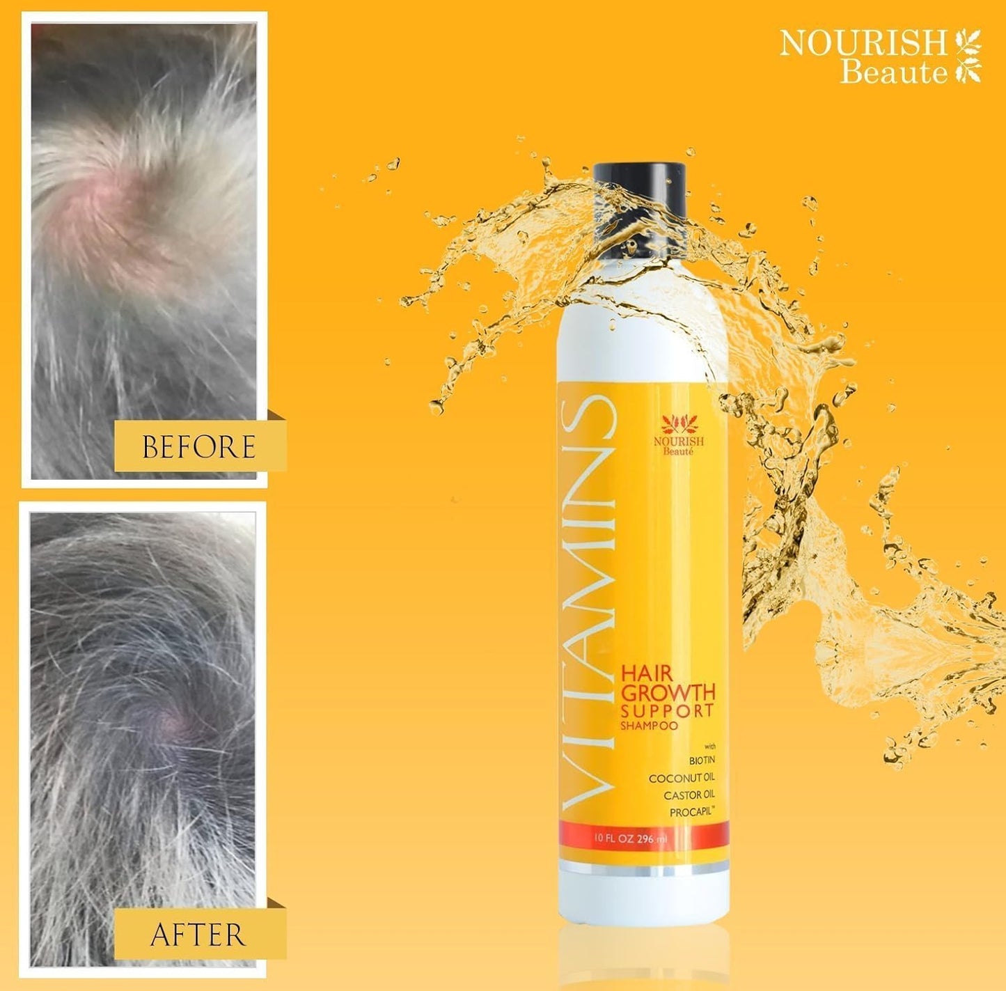 Nourish Beaute Vitamins Shampoo and Conditioner for Hair Loss that Promotes Hair Regrowth, For Men and Women, 4 Pack, 10 Ounces, Each